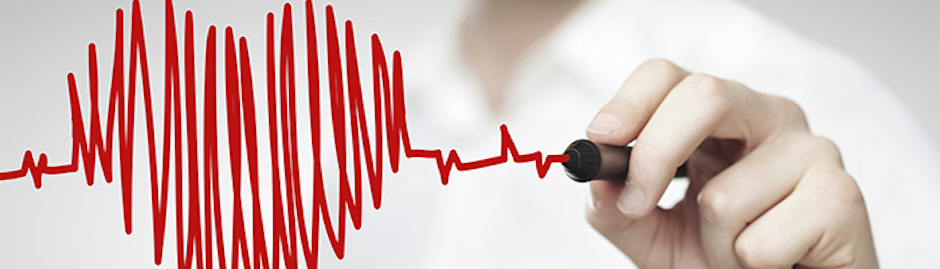 heart attack stroke risk celebrex nsaids